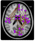 Brain Connectivity